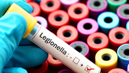 legionellabacterie