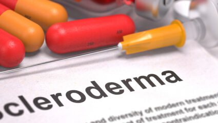 sclerodermie